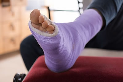 Foot Fractures treatment in the Maricopa County, AZ: Chandler(Dobson Ranch, Kiwanis Park, Tempe, Ocotillo, Sun Lakes, Goodyear Village, Guadalupe, Ahwatukee, Mountain Park Ranch) and Gilbert (The Islands, Val Vista Lakes, Superstition Springs, Reed Park, Power Ranch, Mesa, Queen Creek, Eastmark, Kleinman Park Neighborhood, Lower Santan Village) areas
